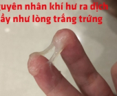 Vùng kín ra nhiều dịch nhầy như lòng trắng trứng