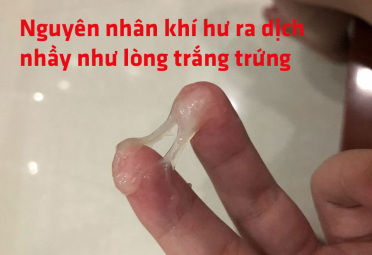 Vùng kín ra nhiều dịch nhầy như lòng trắng trứng