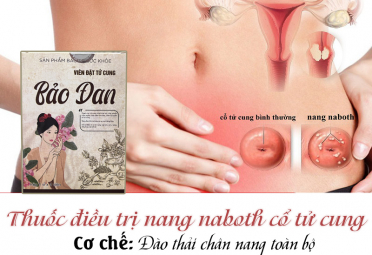 Nang naboth tử cung là gì? Cách phòng và điều trị