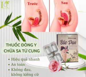 thuốc chữa sa tử cung