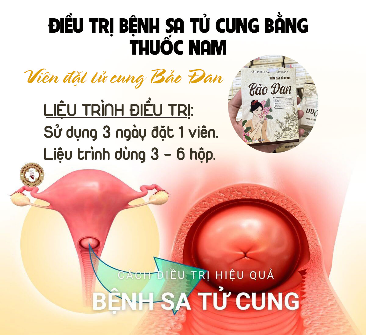 sa tử cung