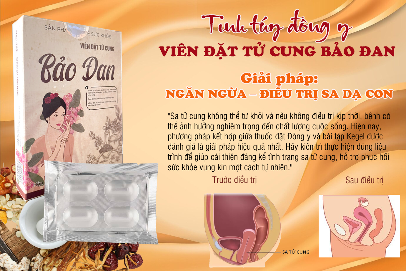 thuốc chữa sa tử cung đông y