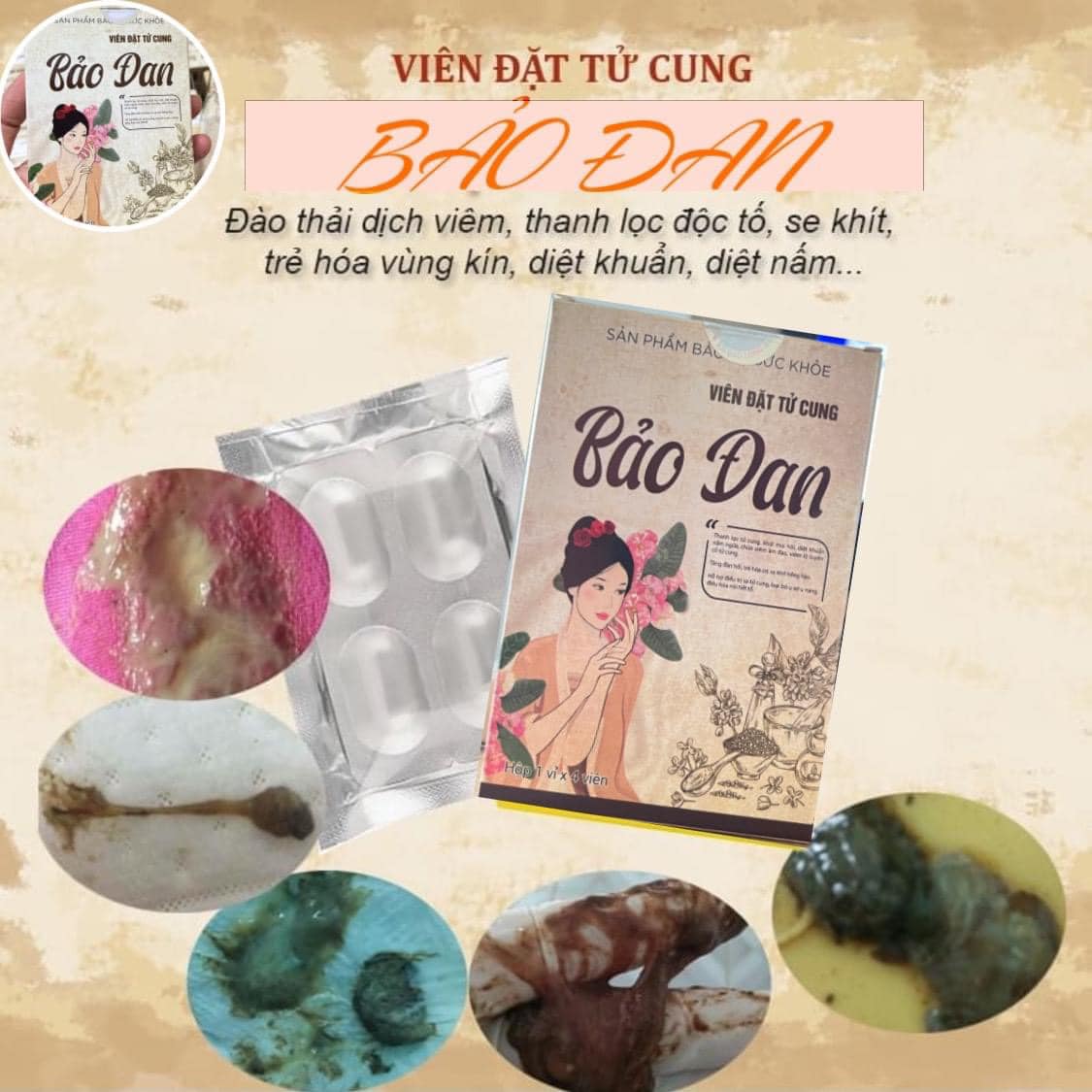 VIÊN ĐẶT TRỊ SƯNG NGỨA HỘT LE