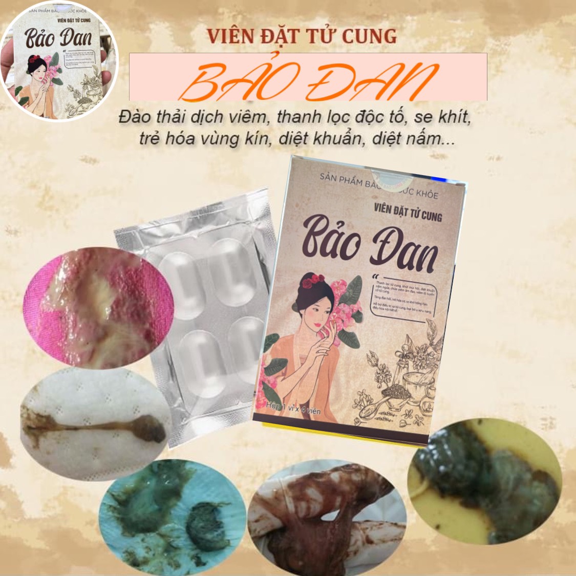 viên đặt phụ khoa bảo đan